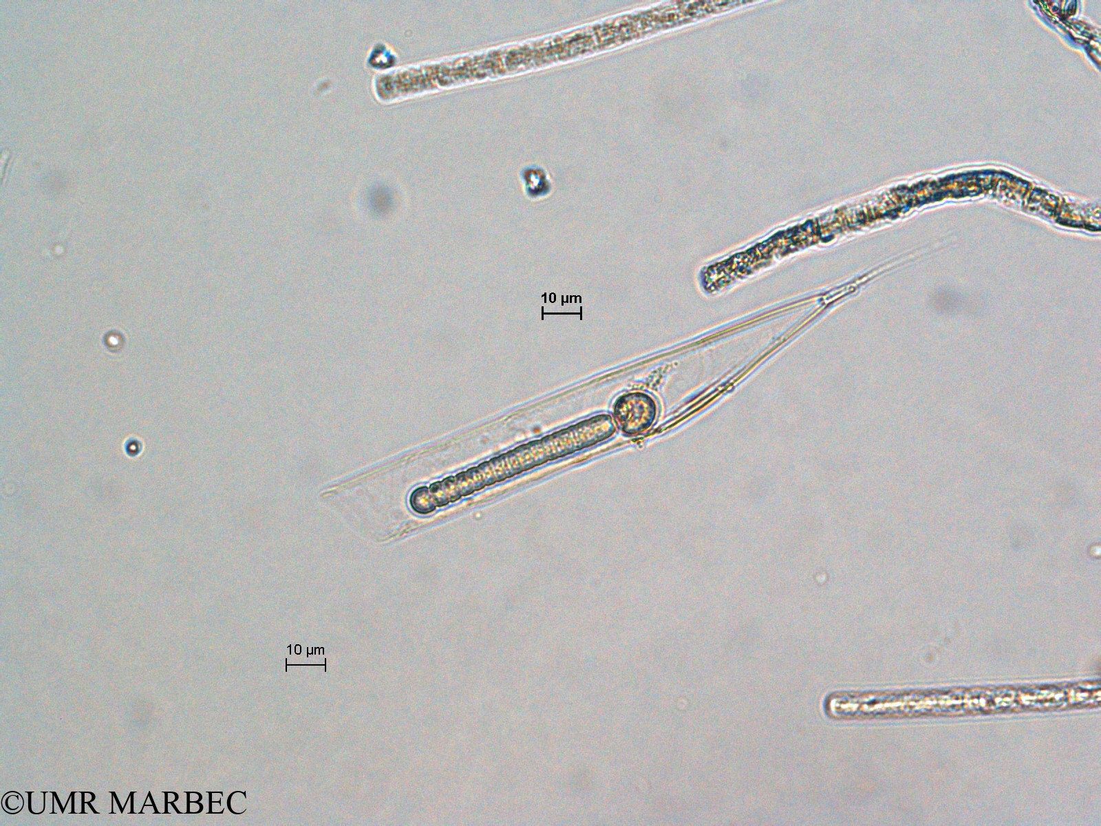 phyto/Scattered_Islands/all/COMMA April 2011/Rhizosolenia styliformis et Richelia intracellularis (ancien R. sp6 et Richelia épiphyte)(copy).jpg